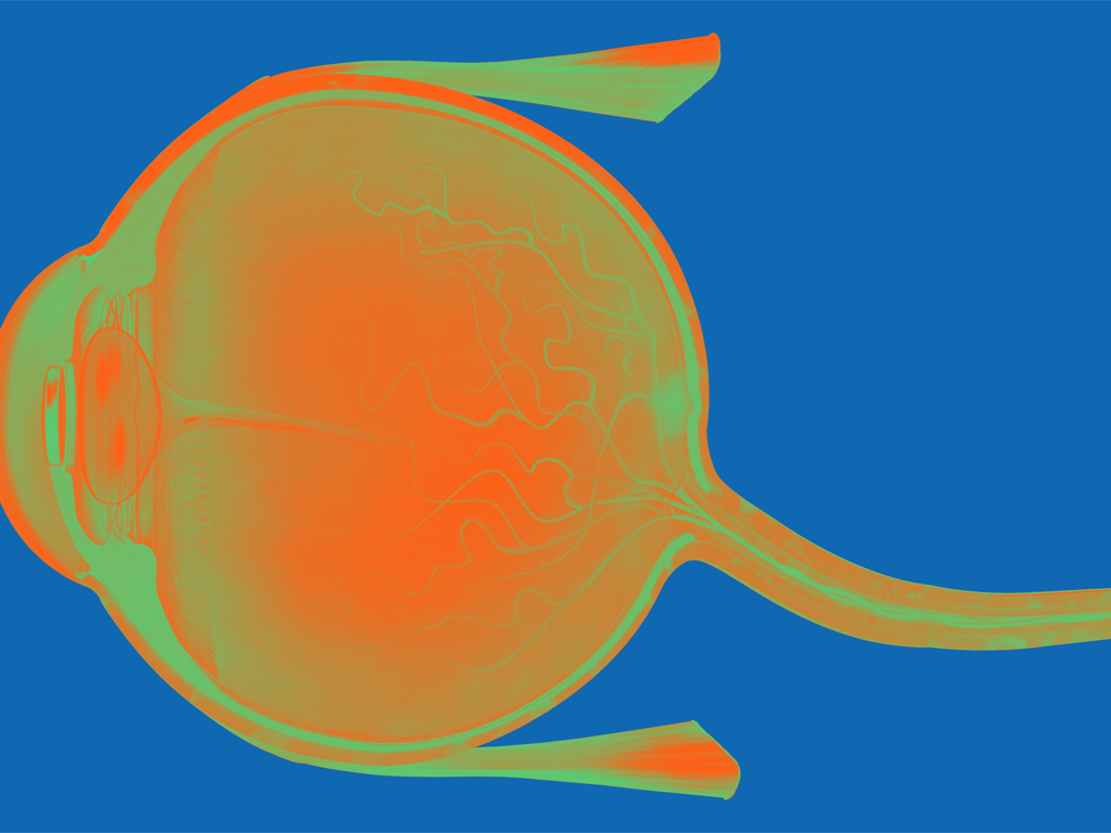 Opthalmology