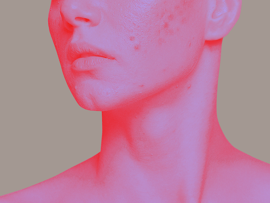 Illustration of textured skin on female lower face.